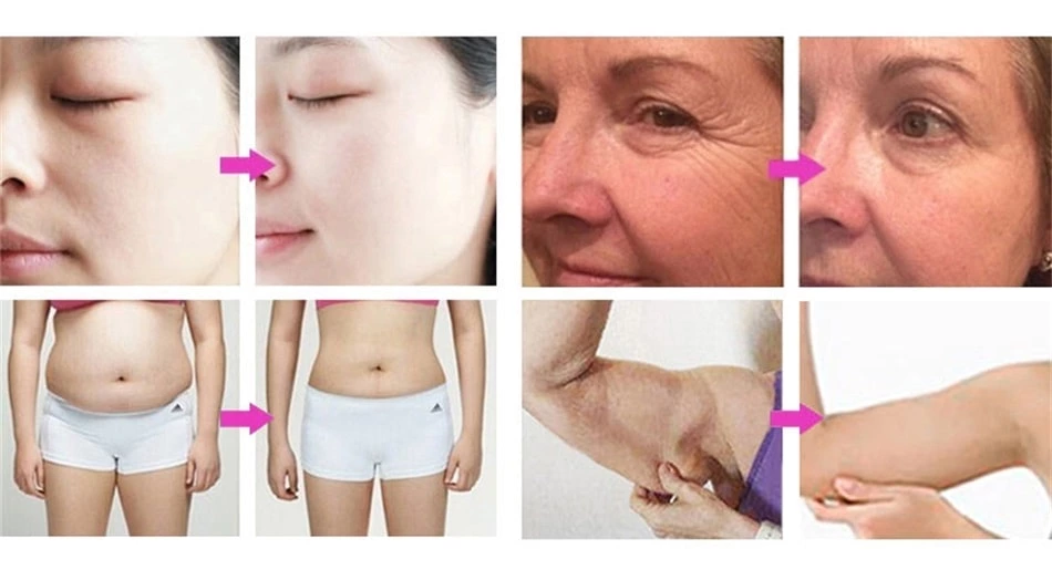 body slimming machine