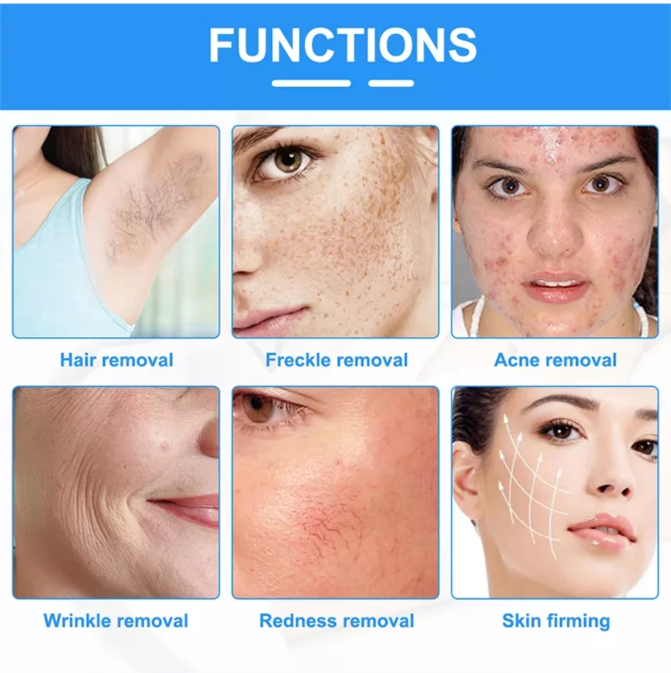 Skin Rejuvenation Skin Tightening Multifunctional Ipl Hair Removal Machine