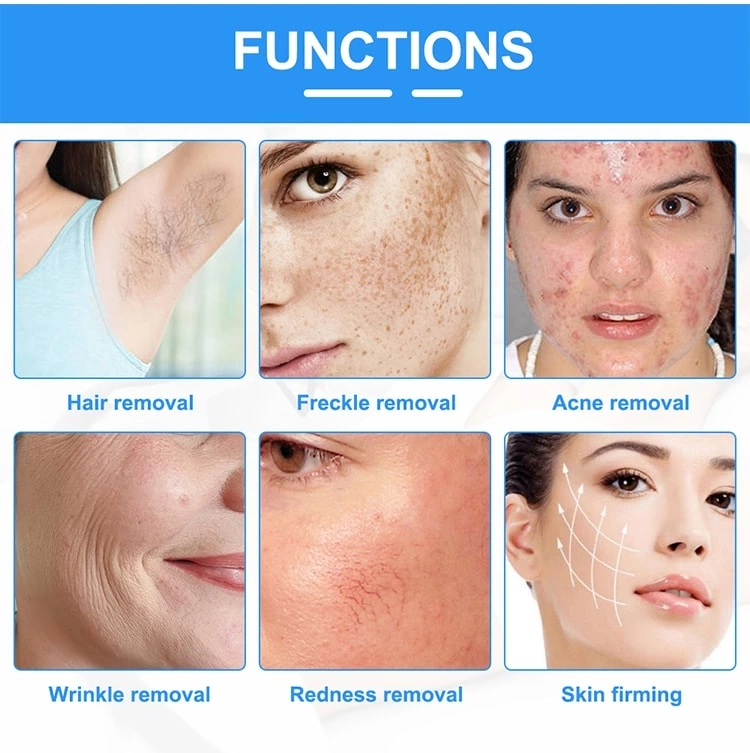Skin Rejuvenation Skin Tightening Multifunctional Ipl Hair Removal Machine