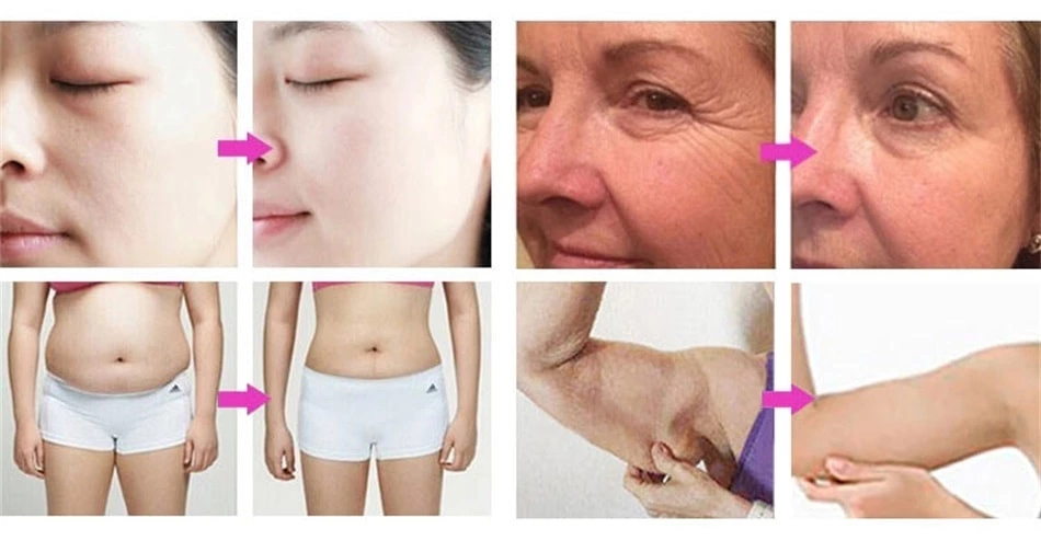 5 in 1 RF Cavitation Slimming Machine