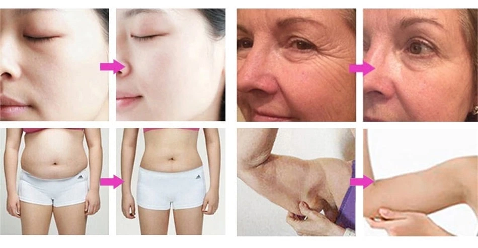6 In 1 Cavitation Machine