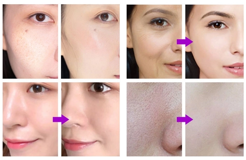 Before and after Skin Moisture Analyzer