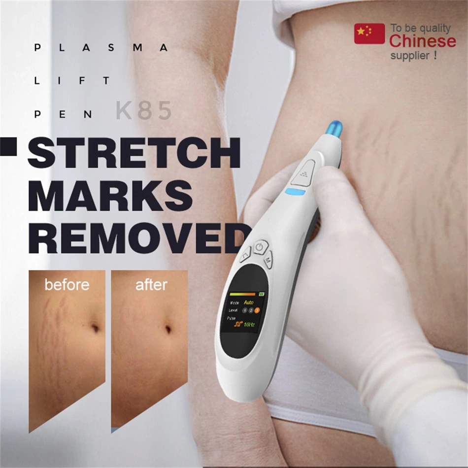 Plasma Pen Stretch Marks