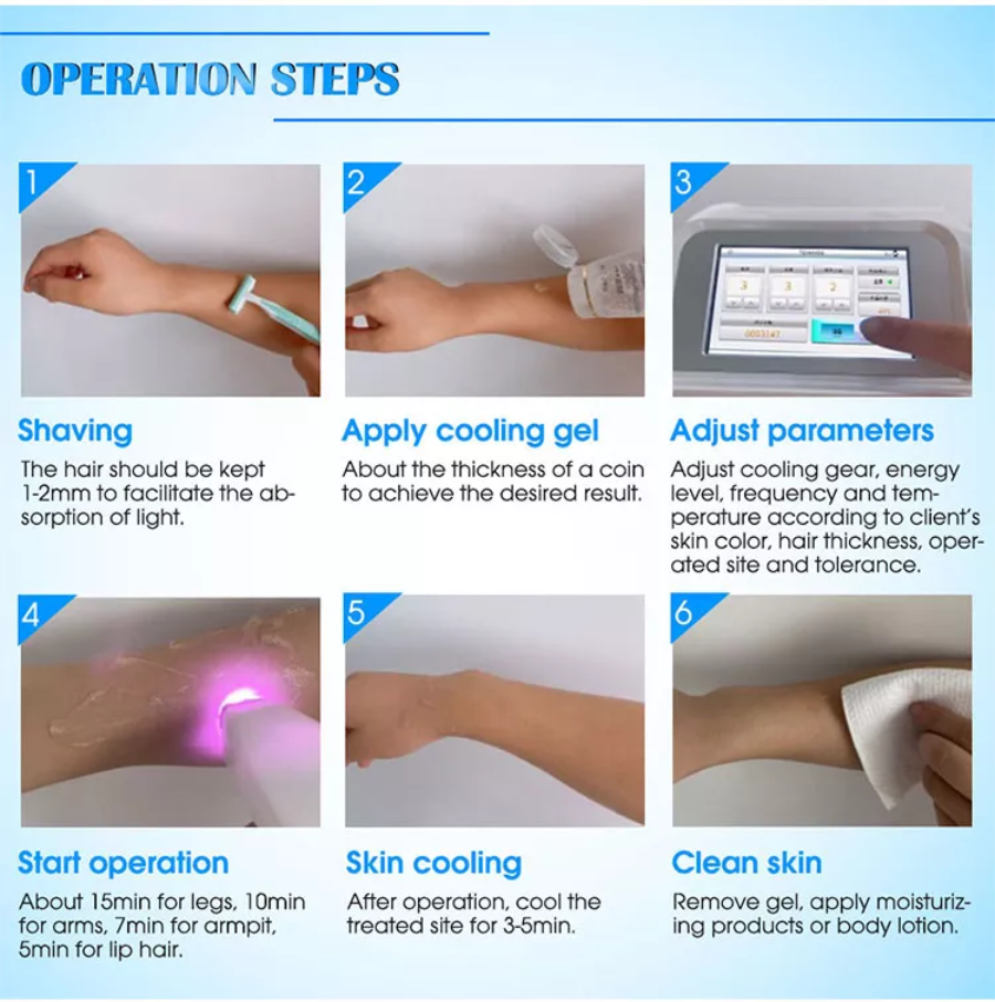 Diode Laser Hair Removal Ibeier Technology