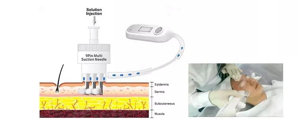 Professional Microneedling Machine