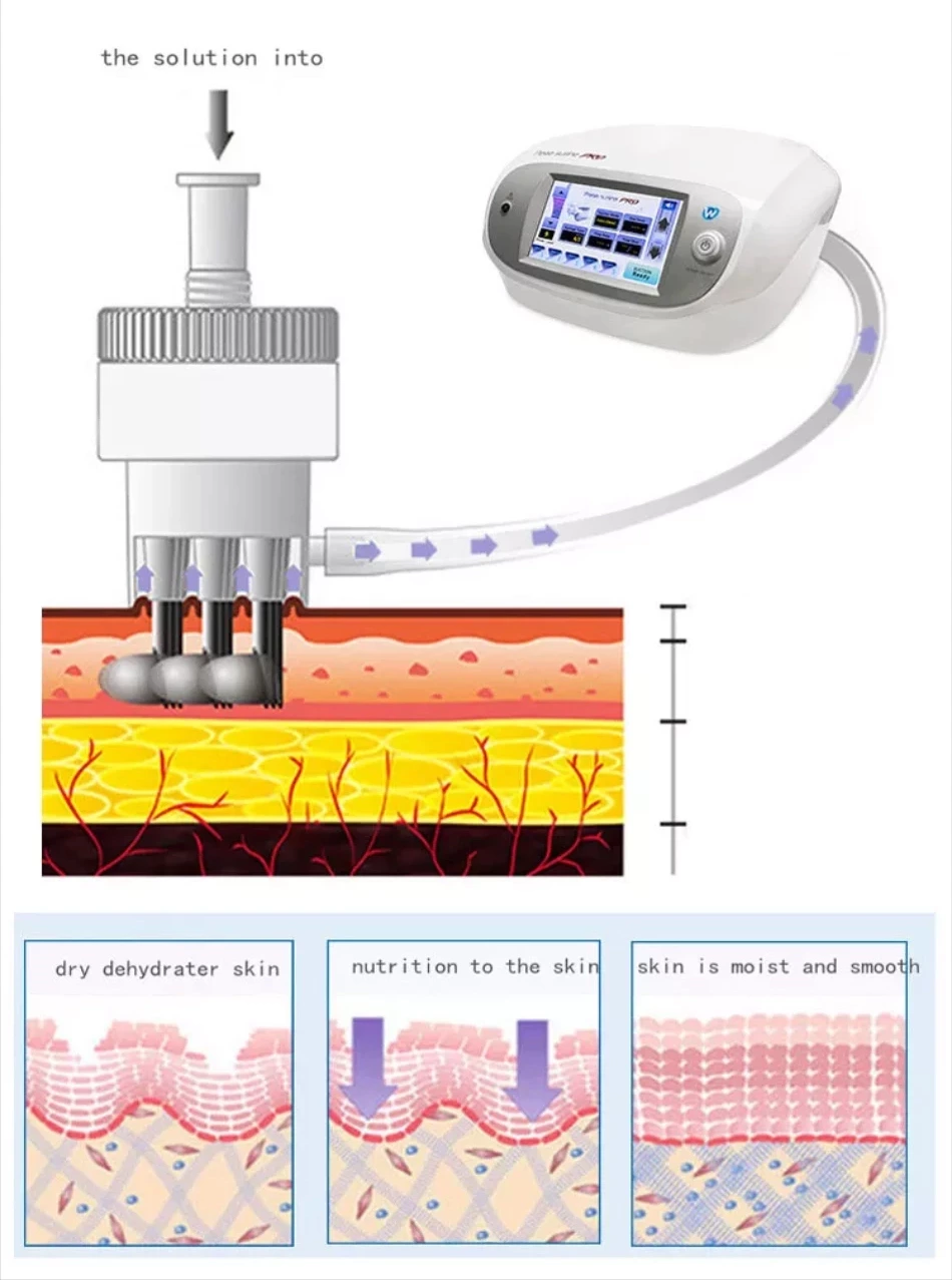 Electroporation Mesotherapy Machine