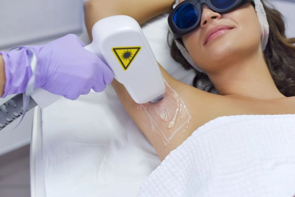 laser hair removal for armpits